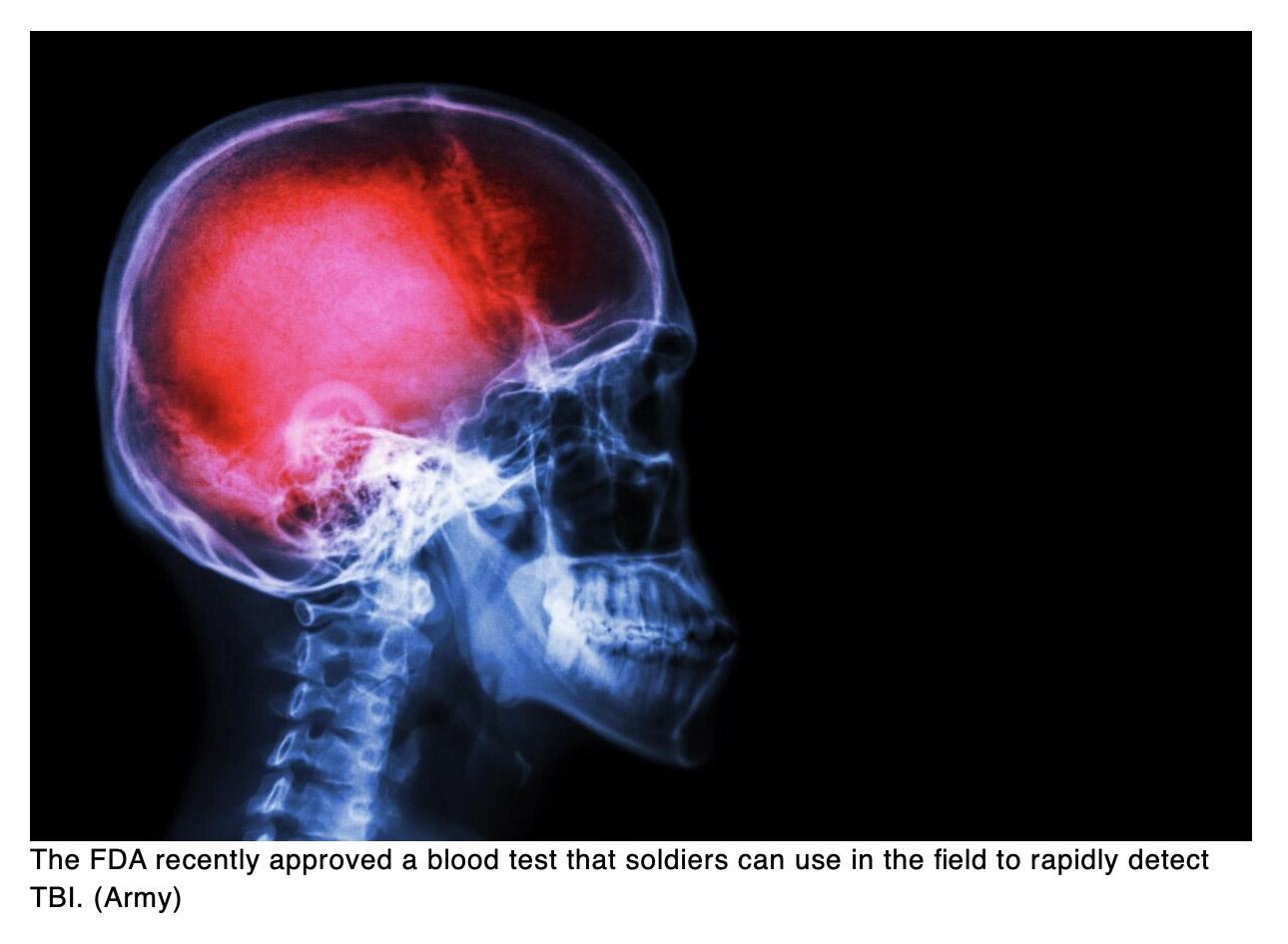  FDA approves Army-developed battlefield TBI blood test